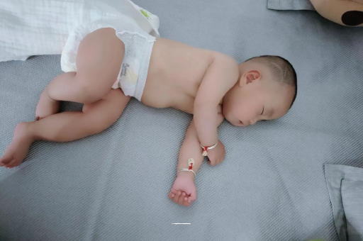 锡林郭勒盟六个月宝宝眼睛散光